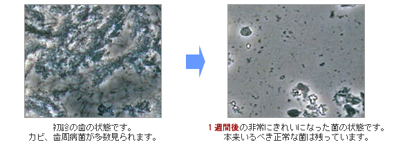 位相差顕微鏡