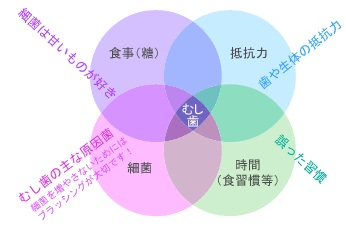 虫歯予防