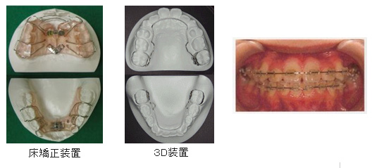 3. 来院3日目以降（約45～60分程度）