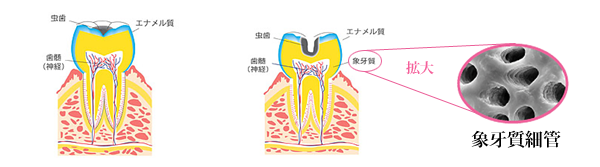 人工的にエナメル質をつくる方法