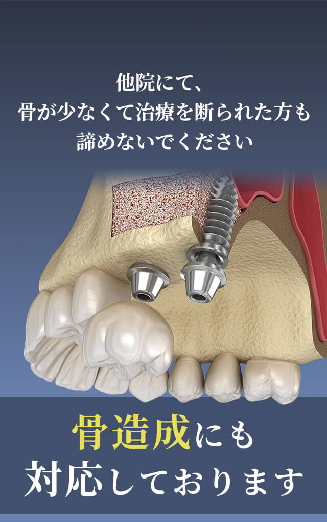 羽曳野市 インプラント