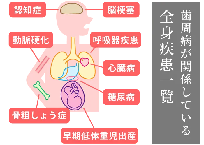 歯周病と全身疾患